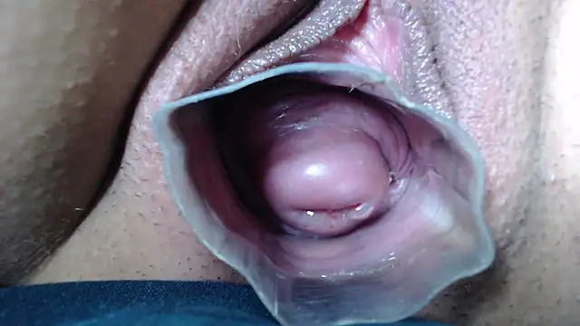 prolapse_uretra (F young) - fuck cervix