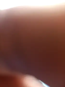 FinableKnee
