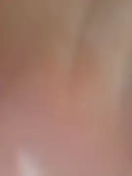 comcoroas