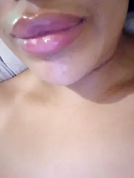 sexlove1xo (F young) - ساعدوني عندي عملية غدة