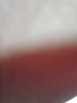 Wettpussyxx webcam
