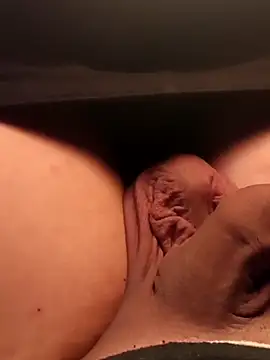 Schamlippenspreitzer