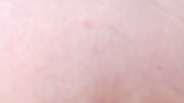 estrellita_fugaz16x (F milf) - come play with my big anal prolapse