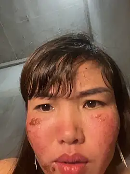 sunny_lotus (F young) - please help me make money to buy medicin