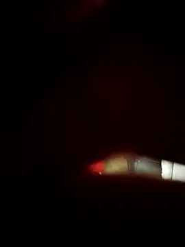 RODRI_POLLADURA webcam