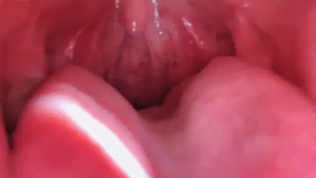 LT-333's Thumb Image