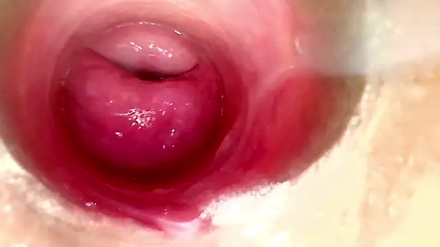 CHOCO ANAL DIRTY ENDOSCOPIO E NEMA SPECULUM I PIG 