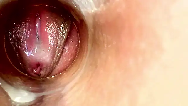 CHOCO ANAL DIRTY ENDOSCOPIO E NEMA SPECULUM I PIG 