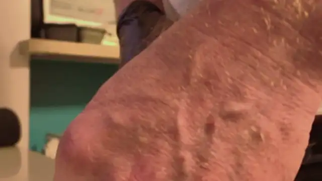 Preview of nylonhype