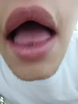 Andres_medi32 webcam