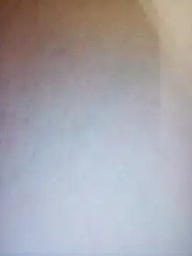 Taking_Scorpion webcam