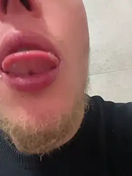 Preview of achillesex22