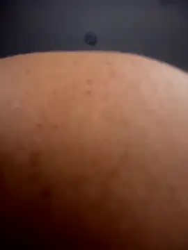 live