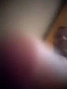 AceticPinscher webcam