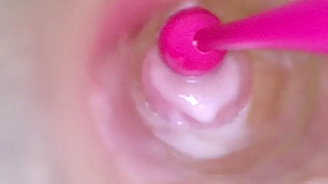 DIRTY  🍫🤎FETISH I NO LIMITS ASK ABOUT YOURS ENDOSCOPIO DIAPER  SPECULUM 