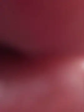 Lilactease