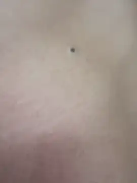 F0X89 webcam