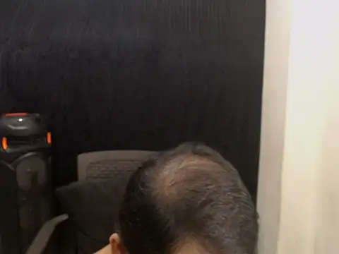 radar777 live cam on StripChat