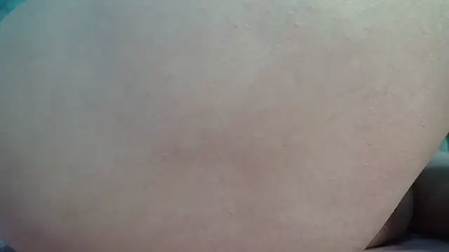 Alida2Anal