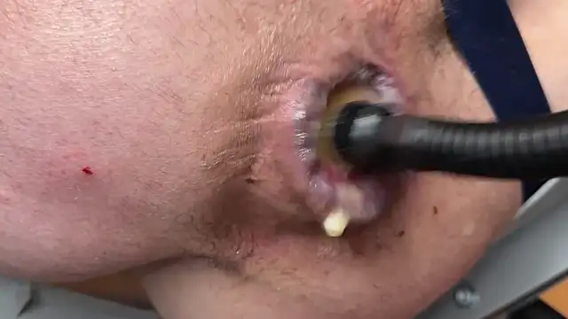 JacsHole webcam