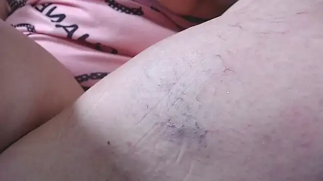estrellita_fugaz16x