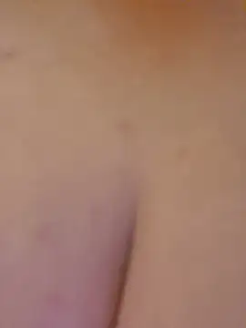YARRAKDELISI