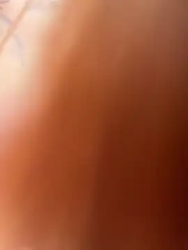 StreetSquirt
