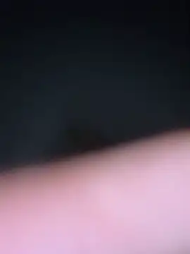 bugballs1