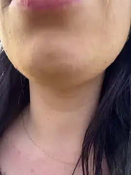 Rafaellaz