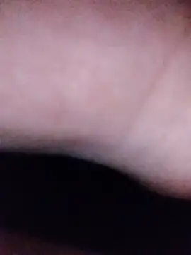 skinblack18