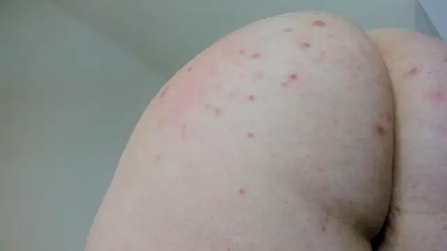 lilacoral7 live webcam