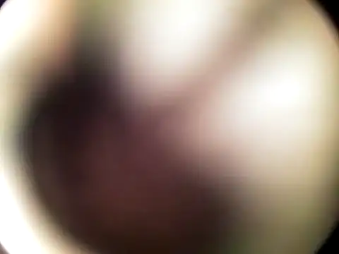 xanderozzz (M young) - To get 2000