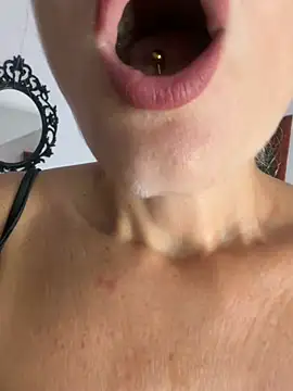slg1
