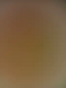 surpesa webcam