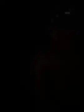 Hotskingirl live cam on StripChat
