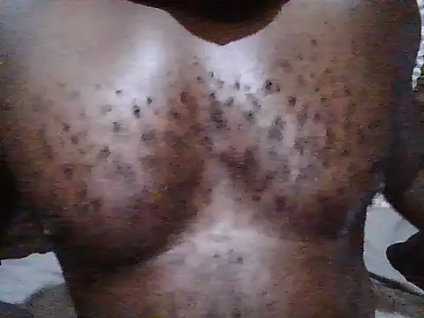 Anulcock