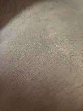 CplAnita