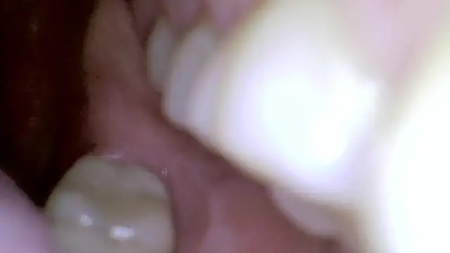 karol_stom