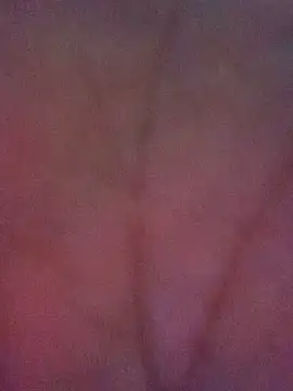 Z_O_A