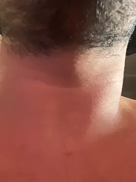 bananahot31