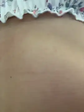 LORA_x