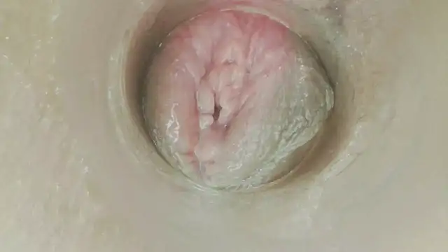 karol_stom