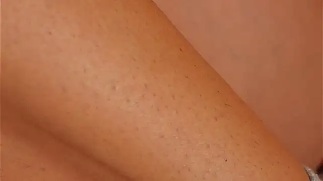 ChiaraWillow