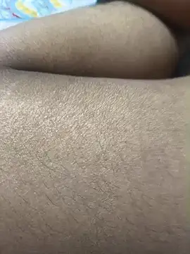CplAnita