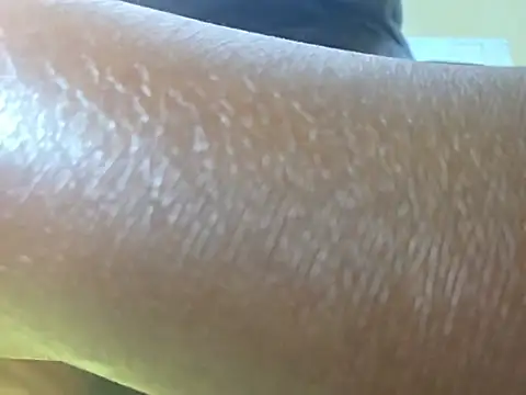 kisserhotter