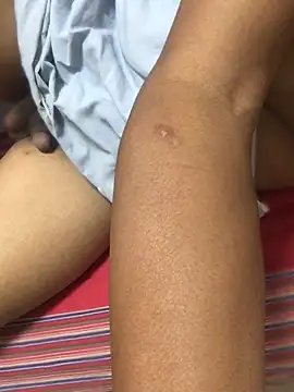 FleckedAlbum
