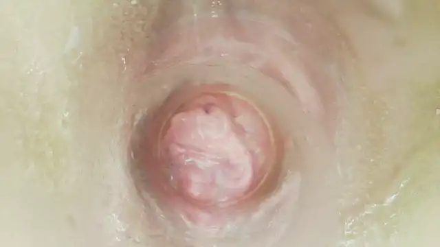 karol_stom