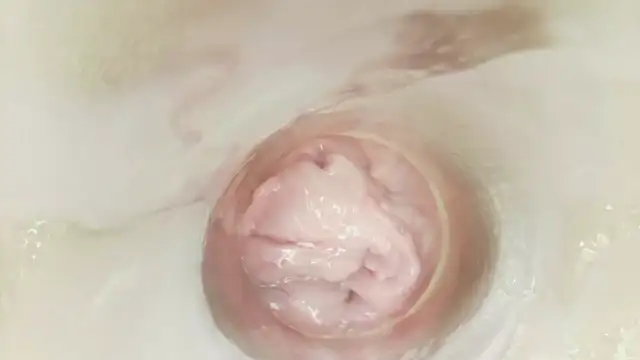 karol_stom
