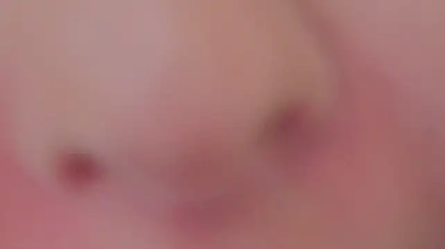 eroimi