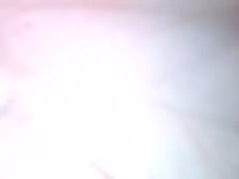 Aulonocara86